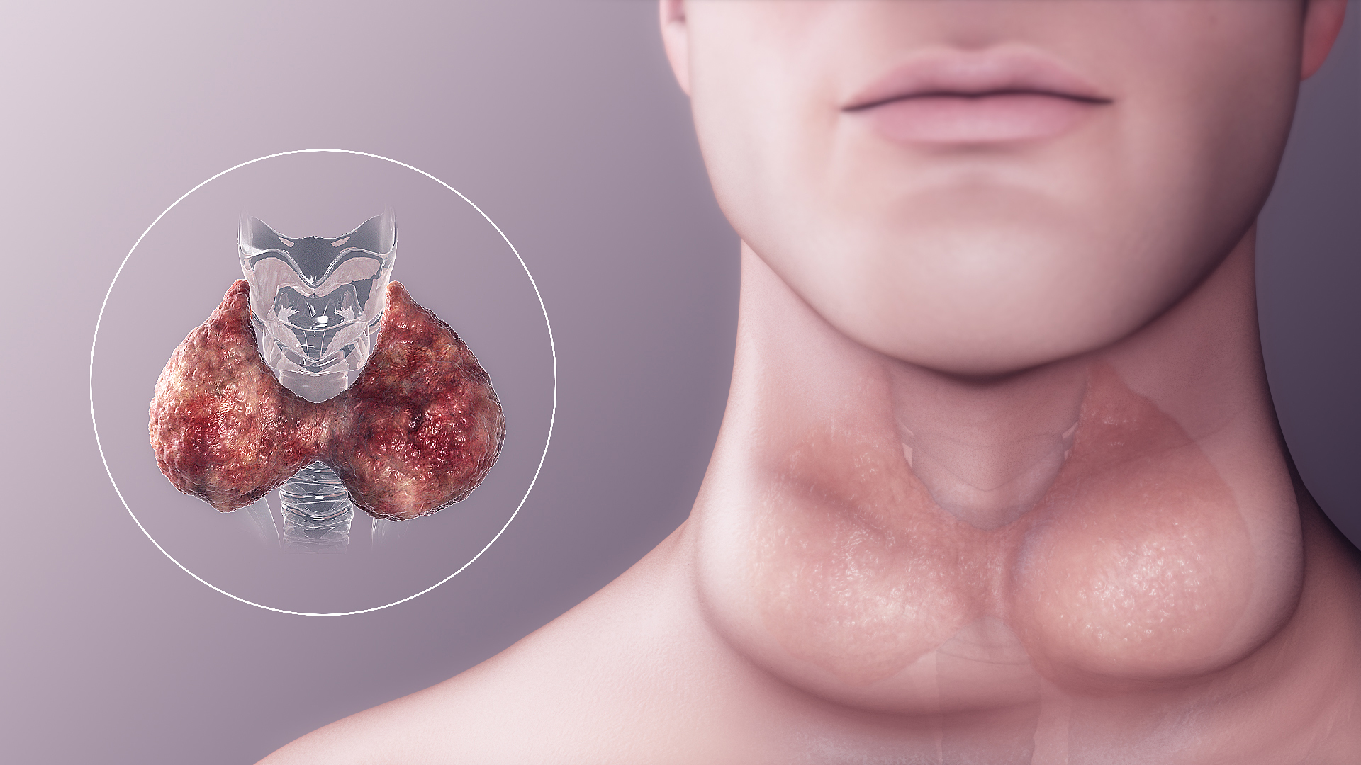 Top 10 Signs of Hypothyroidism: What You Need to Know